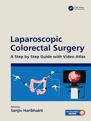 cover image of Laparoscopic Colorectal Surgery